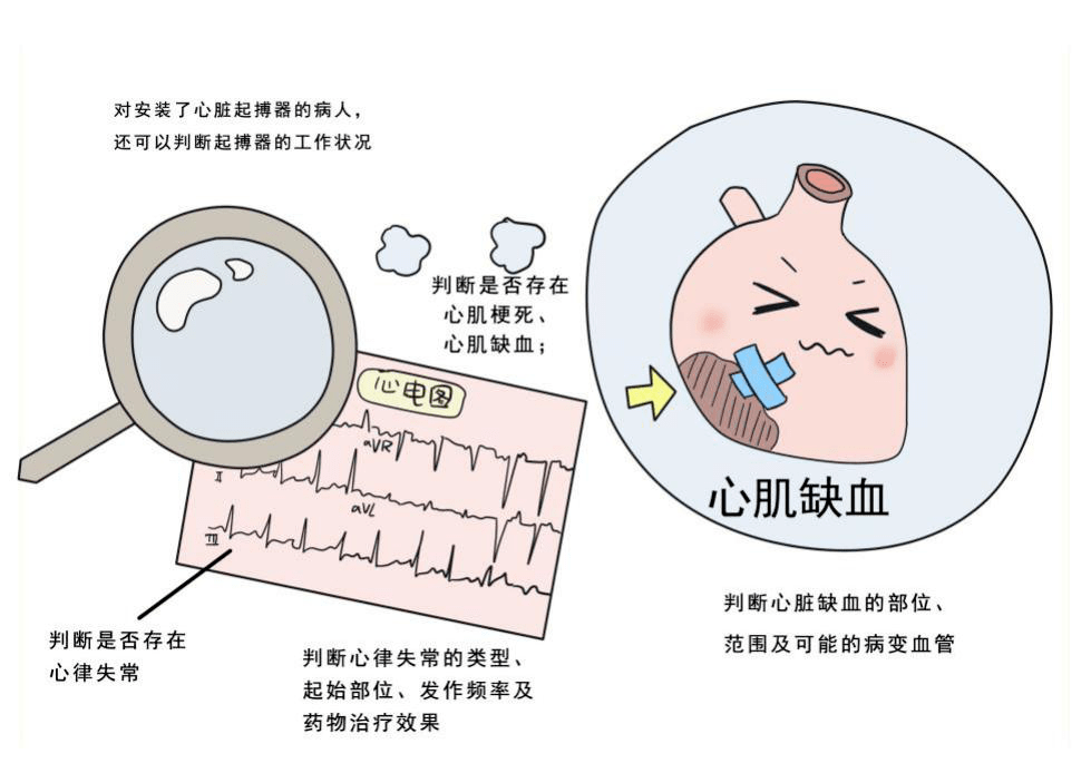 動態(tài)腦電圖的注意事項_做動態(tài)腦電圖注意事項_做動態(tài)腦電時注意什么