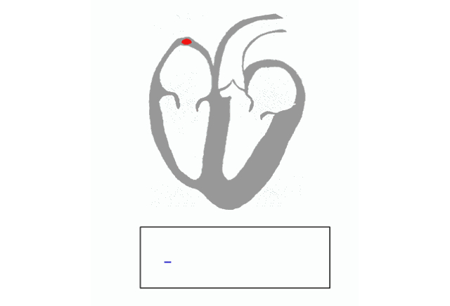 做動態(tài)腦電時注意什么_動態(tài)腦電圖的注意事項_做動態(tài)腦電圖注意事項